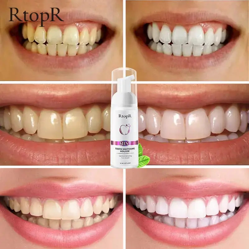 Achieve a dazzling smile with Tooth Whitening Mousse. Gently removes stains, promotes gum health, and restores your natural beauty.