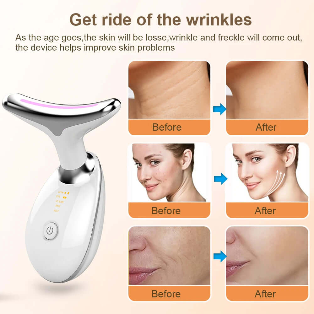 Neck Face Lifting Massager with EMS technology and LED therapy tightens skin, reduces wrinkles, and improves complexion.