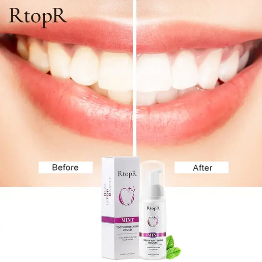 Achieve a dazzling smile with Tooth Whitening Mousse. Gently removes stains, promotes gum health, and restores your natural beauty.